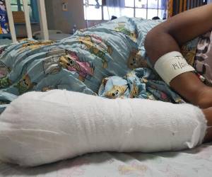 Con las fiestas de fin de año llegan también los menores y adultos que resultan quemados con la explosión de pólvora pese a las prohibiciones en la venta de estos productos en algunas zonas del país. Aquí un recuento de los afectados durante el 31 de diciembre de 2025 y la madrugada del 1 de enero de 2026.