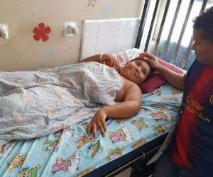 Jorge Daniel Mejía estaba jugando cuando un deslizamiento de tierra en la colonia Centroamérica lo dejó bajo los escombros y lastimó su pierna izquierda.