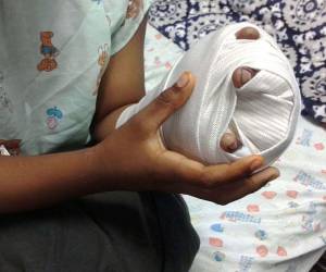 En el Hospital Escuela (HE) de Tegucigalpa tres personas fueron atendidas con quemaduras por pólvora en la emergencia durante la Nochebuena.