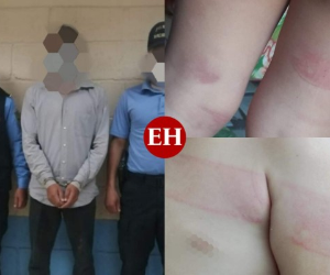 Un equipo de agentes de la Dirección Policial de Investigaciones (DPI) acudió al lugar y constató que el menor presentaba marcas de golpes en sus piernas, pecho y hasta heridas.