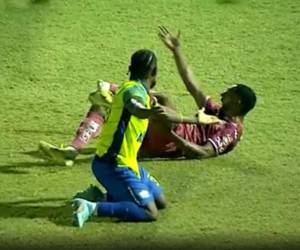 El atacante braseliño Romario da Silva sufrió una lamentable lesión en su tobillo izquierdo que luego de quedarse trabado su taco con la grama tras la disputa de un balón