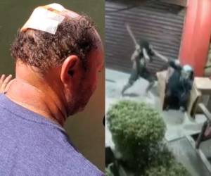 El guardia de seguridad en La Ceiba, Walter González, relata el violento ataque que sufrió en las afueras de un supermercado y denuncia que, aunque identificó y declaró contra el agresor, este quedó libre.