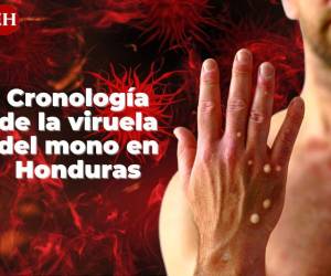 El 12 de agosto pasado se reportaba el primer caso de viruela del mono en Honduras.