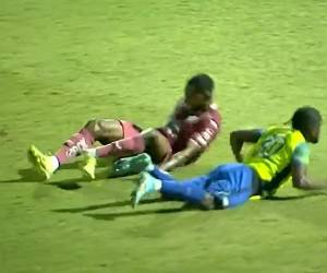 Romario da Silva sufre terrible lesión; se rompe el tobillo en juego de Motagua
