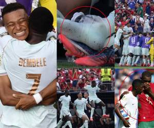 Mbappé salió lesionado y el VAR metido en gran polémica. Las postales que no se vieron en TV del triunfo de Francia sobre Marruecos en el Mundial 2026.