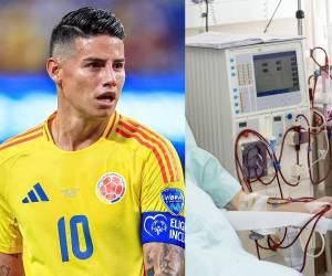 Minnesota United salió al paso y dio todos los detalles del padecimiento que sufre James Rodríguez, que incluso tuvo que ser hospitalizado.
