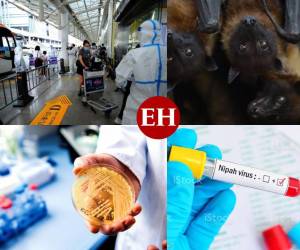 La aparición de nuevos virus desde el 2020, año de la pandemia del covid-19, se han prologando hasta la llegada de la viruela del mono en varios países a nivel mundial. Uno de esos hallazgos es la presencia del hepanivirus. En la siguiente galería le mostraremos los datos más actualizado sobre el hepanivirus, síntomas, tratamientos, entre otros.