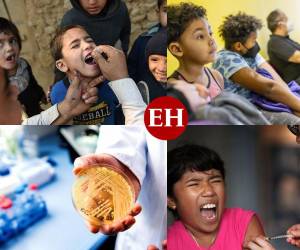 Después de las restricciones originadas a causa del covid-19, es natural que nos sintamos alarmados por la aparición de nuevos virus como la viruela del mono, que se originó en África, En la siguiente galería le mostraremos los virus que provocan zozobra en 2022.