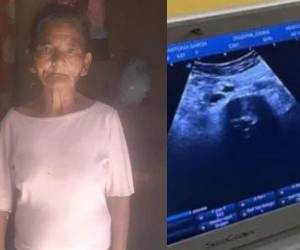 “La señora presenta parásitos y dos hernias”, refirió el doctor, lo que habría levantado sus sospechas de gestación.