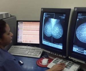 Mediante este estudio, los especialistas pueden identificar cáncer de mama, quistes u otras alteraciones que requieren evaluación médica.
