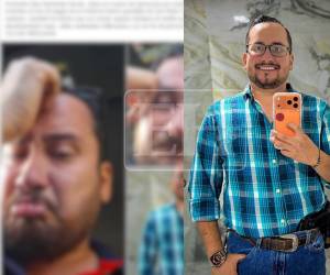 Envuelto en sábanas fue dejado el cadáver de Fernando Elías Sarmiento Rauda, en la carretera CA-5, hacia el norte de Honduras. ¿Qué se sabe sobre este caso? Aquí los detalles:
