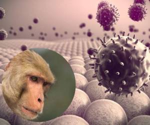 Riesgo de contagio de la viruela del mono es “muy bajo”, según autoridades sanitarias