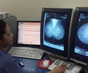 Las mujeres que detecten un bulto, cambios en la forma de las mamas, hundimientos o secreciones deben buscar atención médica para que un profesional evalúe los síntomas y determine los estudios necesarios.