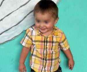 Ricardo Noel García Cortez, un menor de apenas dos años y dos meses de edad, perdió la vida luego de sufrir múltiples quemaduras durante un incendio registrado en su propia vivienda en Ocotepeque.