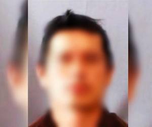 En cuestión de segundos y sin mediar palabra, el acusado le propinó un machetazo en la cabeza. La agresión dejó una herida de gravedad en la región frontal izquierda del menor.