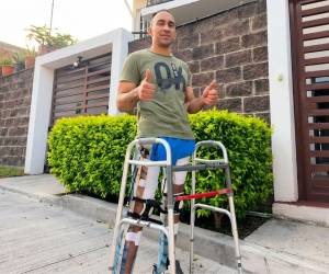 El paracaidista de la Fuerza Aérea Hondureña, Ever Maldonado, sigue en su proceso de recuperación en casa.