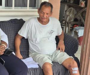 Don César fue atacado el pasado 5 de septiembre y estuvo interno en el Hospital de Atlántida.
