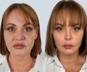 Gaby Spanic generó gran reacción en redes tras mostrar los resultados de su reciente paso por una clínica especializada en São Paulo, Brasil. La actriz venezolana exhibió comparativos en sus historias de Instagram que evidencian cambios en su rostro y silueta facial, despertando comentarios sobre su aspecto rejuvenecido.
