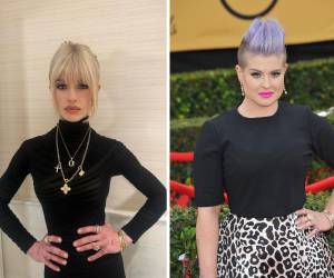 Kelly Osbourne ha mostrado un cambio radical tras someterse en 2018 a un tratamiento de manga gástrica, pero ha generado preocupación por su extrema delgadez actual.