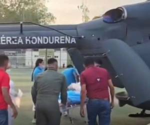 El menor fue trasladado a Tegucigalpa vía aérea, sin embargo, debido a las fuertes quemaduras en su cuerpo, falleció.