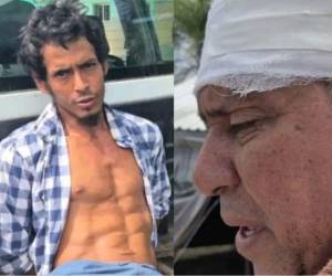 Un padre fue agredido por su hijo en La Ceiba, quien presuntamente le lanzó una taza de café y luego, lo golpeó.