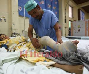 En marcha programa para corregir el pie equinovaro en niños en Honduras