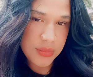 La mujer hondureña asesinada en Figueres, Girona, fue identificada de manera preliminar por personas cercanas como Kimberli Durán García, integrante de la comunidad LGTBQ+, mientras las autoridades continúan con el proceso oficial de confirmación de identidad. Su muerte causa conmoción entre hondureños en España.
