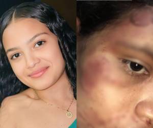 Con tan solo 19 años de edad, Dayani Acosta vive con temor por su vida y la de sus dos pequeños, luego de recibir amenazas de su expareja y de la familia de él, tras haber sido atacada a mordidas y mantenida encerrada en su vivienda. Esto relató su madre.