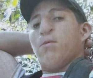 Debido a la gravedad de las quemaduras, fue trasladado de emergencia al principal centro asistencial del país, donde permaneció bajo atención médica durante 12 días, pero finalmente perdió la vida.