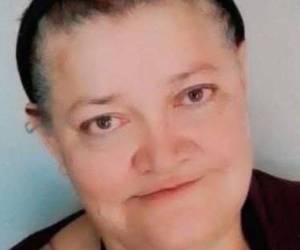 Bomberos utilizaron agua a presión para separar a los perros y rescatar a la víctima, quien falleció días después en el hospital.