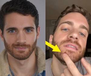 Mathias Ford mostró parte del sarpullido en su piel a través de sus redes sociales, luego de haber transcurrido su tiempo de aislamiento.