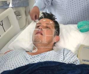 El diputado Octavio Morales Bonilla fue operado con éxito para recibir un corazón artificial en México.