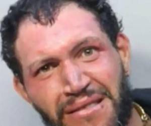 Un cubano de 27 años falleció bajo custodia del Servicio de Inmigración y Aduanas de Estados Unidos (ICE) en Miami, según reveló esta agencia el viernes, siendo la decimoséptima muerte de este tipo en lo que va del año fiscal 2026 y la número 49 bajo la Administración de Donald Trump.