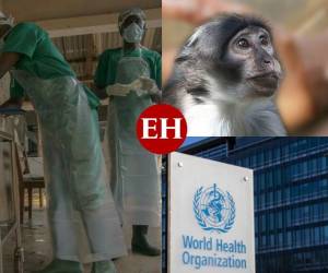 La viruela del mono o viruela símica es una enfermedad causada por un virus que, como menciona su nombre, se propaga entre los monos en varias regiones en África, pero también contagia a las personas ocasionando brotes. ¿Qué más se sabe?