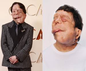 Adam Pearson caminó por la alfombra roja de los Premios Oscar 2026, llevando un mensaje de inclusión y resiliencia a uno de los escenarios más importantes del cine mundial.