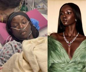 La supermodelo Anok Yai fue hospitalizada recientemente debido a complicaciones de salud que venía ignorando desde hace meses.