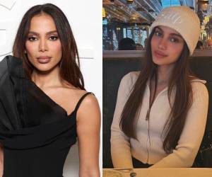 La cantante y bailarina brasileña, Larissa de Macedo Machado, más conocida en el mundo artístico como Anitta, sorprendió a sus fanáticos y demás usuarios de redes en el mundo, tras haber publicado fotografías en las que luce un rostro completamente diferente. ¿Se sometió a más cirugías? Esto se sabe.