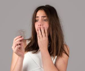 La alopecia en mujeres es muy común y suele avanzar de manera más difusa y menos visible en sus etapas iniciales.