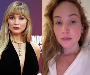 Jennifer Lawrence detalló en una entrevista los tratamientos estéticos que se ha practicado, desde el bótox hasta una elevación de pecho.