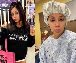 La protagonista de Jersey Shore compartió detalles de su cirugía y del proceso posterior, en el que reconoció atravesar un momento difícil pero mantener una actitud positiva.