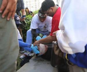 El CONADEH manifestó especial preocupación por el caso de Axel Josué Medina Castellanos, quien resultó gravemente herido durante los disturbios, perdiendo su ojo izquierdo.