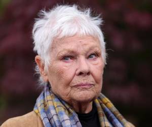 La actriz británica Judi Dench, ganadora del Óscar en 1999, dijo que la afección ocular que padece desde 2012 le impide actuar en teatro, participar en películas e incluso leer.