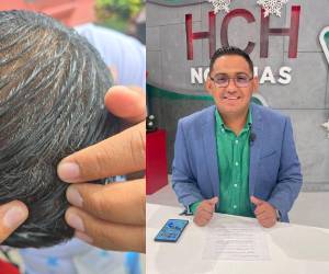 Distintos sectores del país han condenado el ataque de los supuestos colectivos de Libre al periodista de HCH, Luis Anariba.