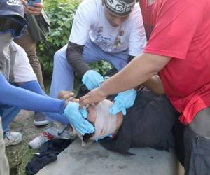 Axel Josué Medina Castellanos, estudiante de la carrera de Trabajo Social y presidente del comité estudiantil, fue herido en una protesta estudiantil.