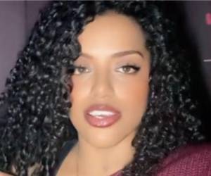 Una joven motociclista falleció la mañana del martes 24 de marzo en un accidente registrado en el kilómetro 7, a la altura de la aldea El Chimbo, en la vía que conecta Santa Lucía con Tegucigalpa.