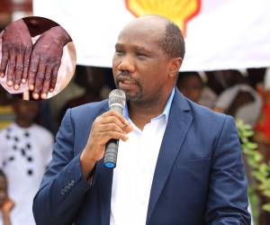 El doctor Dimie Ogoina es profesor de medicina y enfermedades infecciosas en la Universidad del Delta del Níger en Nigeria.