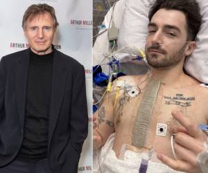 Daniel Neeson, hijo menor del actor Liam Neeson, compartió este miércoles a través de Instagram que ha sido intervenido quirúrgicamente a causa de una válvula aórtica bicúspide, una malformación cardíaca congénita con la que nació y que requirió atención médica antes de lo previsto.