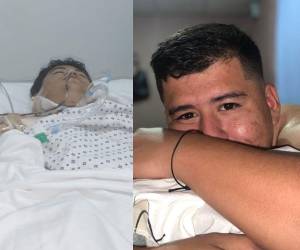 Pese a las operaciones realizadas para salvar su vida, Brayan Fernández falleció la noche del martes en el hospital Mario Catarino Rivas, luego de permanecer varios días hospitalizado.