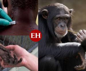 La viruela del mono, de la que se detectaron varios casos en Europa y América del Norte, es una enfermedad rara originaria de África que suele curarse espontáneamente.