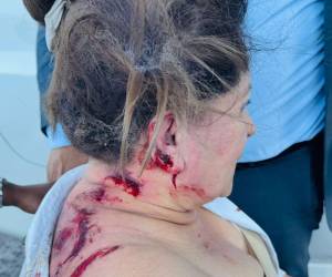 ¿Quién atacó a Gladys Aurora López, diputada del Partido Nacional, con un explosivo? Esto es lo que se sabe hasta el momento sobre el condenable hecho hacia la diputada nacionalista al Parlacen.